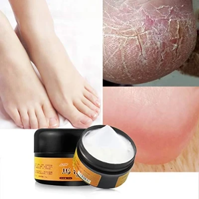 Abbildung von Allbestaye Foot Repair Skin Healing Cream for Thick Cracked Rough Dead Dry Skin, Moisturizing Callus Care Feet Elbows Hands,Exfoliating Heels and
