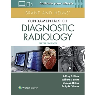 Abbildung von Brant and Helms&#039; Fundamentals of Diagnostic Radiology