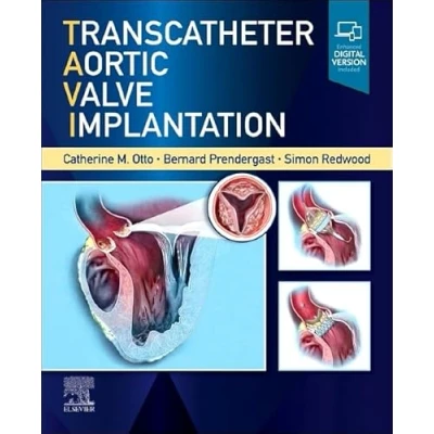 Abbildung von Transcatheter Aortic Valve Implantation: Current and Future Developments