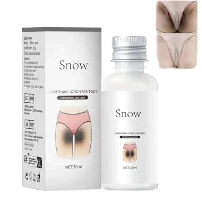 Abbildung von Bleichcreme für Den Intimbereich,Hautaufhellungscreme Achselhöhlen,Aufhellungscreme Dunkelfleckenentferner,Dunkelflecken Korrekturcreme Intimbereiche,Achselhöhlen,Innenschenkel&amp; Bikinizone (1)