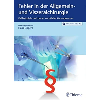 Abbildung von Fehler in der Allgemein und Viszeralchirurgie: Fallbeispiele deren rechtliche Konsequenzen