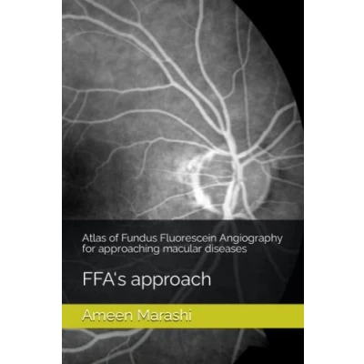 Abbildung von Atlas of Fundus Fluorescein Angiography for approaching macular diseases: FFA&#039;s approach (Atlas OCT diseases, Band 2)