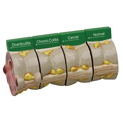 Abbildung von GPI Anatomicals 3341 Dickdarm 4 Scheibenmodell