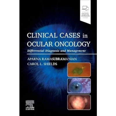 Abbildung von Clinical Cases in Ocular Oncology: Differential Diagnosis and Management
