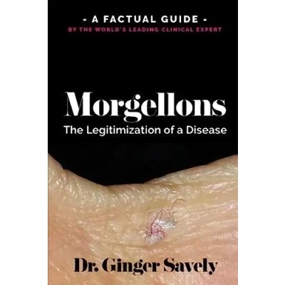 Abbildung von Morgellons: the legitimization of A disease: Factual Guide by World&#039;s Leading Clinical Expert