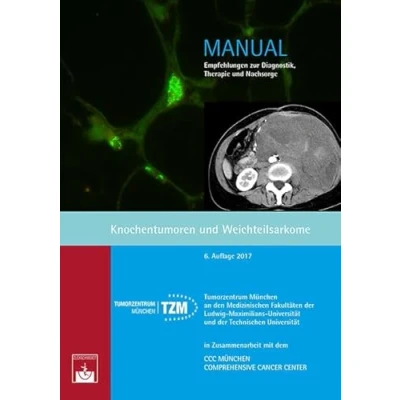 Abbildung von Knochentumoren und Weichteilsarkome: Empfehlungen zur Diagnostik, Therapie Nachsorge (Manuale Tumorzentrum München)