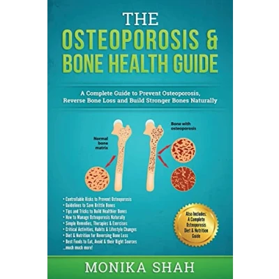 Abbildung von Osteoporosis: The Osteoporosis &amp; Bone Health Guide: A Complete Guide to Prevent Osteoporosis, Reverse Loss and Build Stronger Bones Naturally