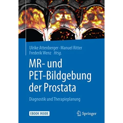 Abbildung von MR und PET Bildgebung der Prostata: Diagnostik Therapieplanung