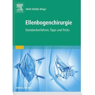Abbildung von Ellenbogenchirurgie: Standardverfahren, Tipps und Tricks: Atlas zu Tricks
