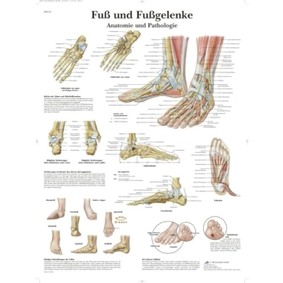 Abbildung von 3B Scientific Lehrtafel Fuß und Fußgelenke Anatomie Pathologie, VR0176UU