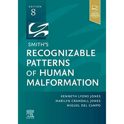 Abbildung von Smith&#039;s Recognizable Patterns of Human Malformation: Expert Consult Online and Print