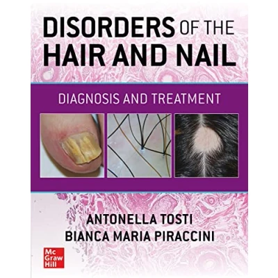 Abbildung von Disorders of the Hair and Nail: Diagnosis Treatment