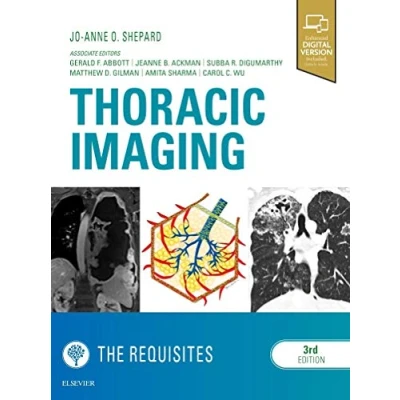 Abbildung von Thoracic Imaging The Requisites: Enhanced Digital Version Included. Details inside (Requisites in Radiology)