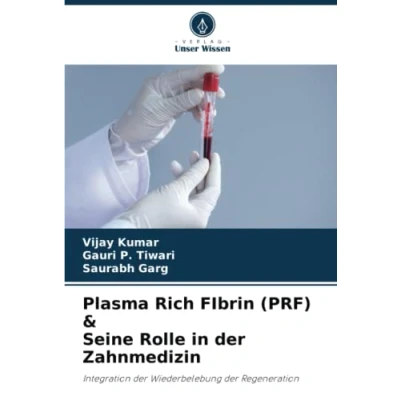 Abbildung von Plasma Rich FIbrin (PRF) &amp; Seine Rolle in der Zahnmedizin: Integration Wiederbelebung Regeneration