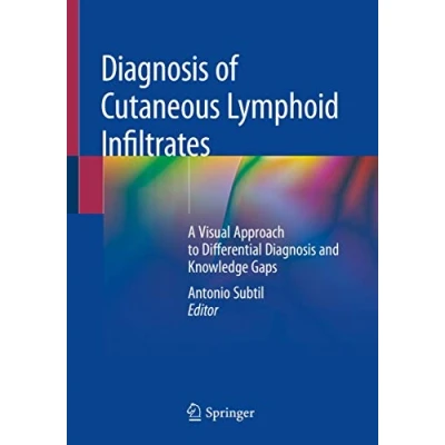 Abbildung von Diagnosis of Cutaneous Lymphoid Infiltrates: A Visual Approach to Differential and Knowledge Gaps