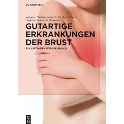 Abbildung von Gutartige Erkrankungen der Brust: Ein Leitfaden für die Praxis