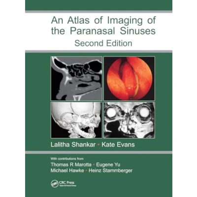 Abbildung von An Atlas of Imaging the Paranasal Sinuses