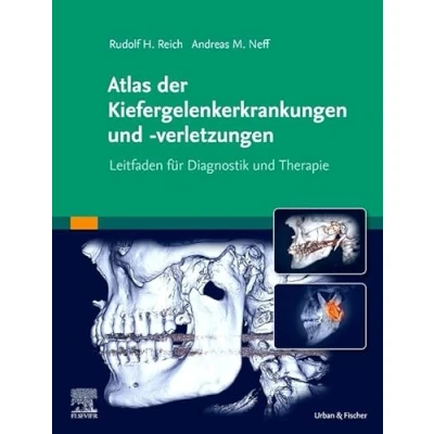 Abbildung von Atlas der Kiefergelenkerkrankungen und verletzungen: Leitfaden für Diagnostik Therapie