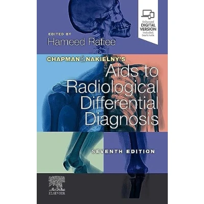 Abbildung von Chapman &amp; Nakielny&#039;s Aids to Radiological Differential Diagnosis: Expert Consult Online and Print