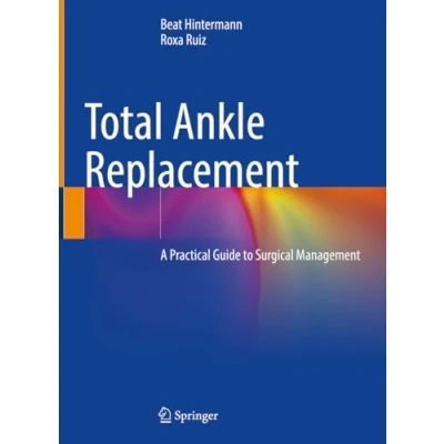 Abbildung von Total Ankle Replacement: A Practical Guide to Surgical Management