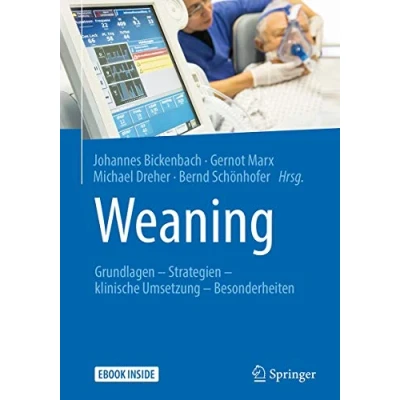 Abbildung von Weaning: Grundlagen Strategien klinische Umsetzung Besonderheiten