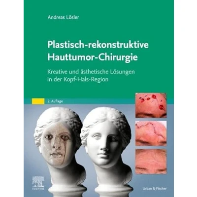 Abbildung von Plastisch rekonstruktive Hauttumor Chirurgie: Kreative und ästhetische Lösungen in der Kopf Hals Region