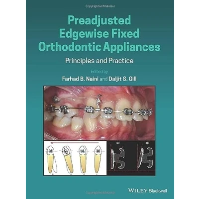Abbildung von Preadjusted Edgewise Fixed Orthodontic Appliances: Principles and Practice