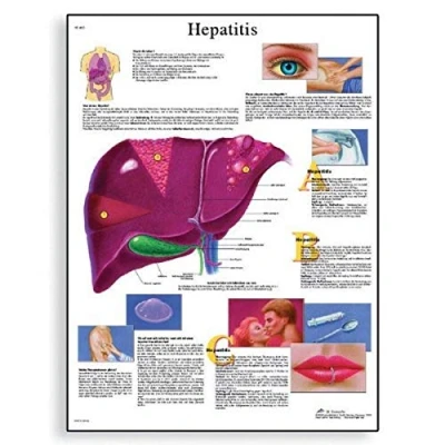 Abbildung von 3B Scientific Human Anatomy Hepatitis Diagramm, Papierversion