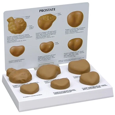 Abbildung von GPI Anatomicals W33366 Prostata Modell