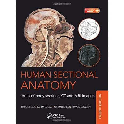 Abbildung von Human Sectional Anatomy: Atlas of Body Sections, CT and MRI Images, Fourth Edition