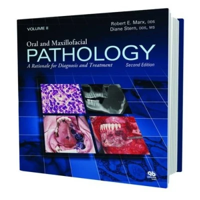Abbildung von Oral and Maxillofacial Pathology: A Rationale for Diagnosis Treatment