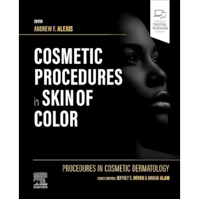 Abbildung von Procedures in Cosmetic Dermatology: Skin of Color