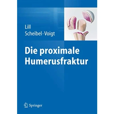 Abbildung von Die proximale Humerusfraktur: Neue Techniken Implantate Tipps und Tricks