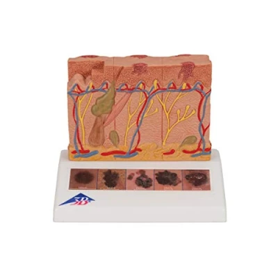 Abbildung von 3B Scientific Menschliche Anatomie Hautkrebs Modell + kostenlose App Smart Anatomy, J15
