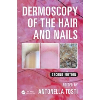 Abbildung von Dermoscopy of the Hair and Nails