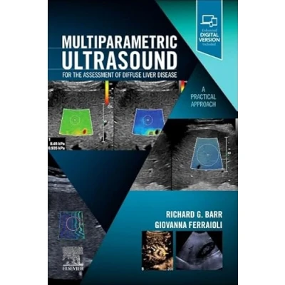 Abbildung von Multiparametric Ultrasound for the Assessment of Diffuse Liver Disease: A Practical Approach