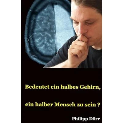 Abbildung von Bedeutet ein halbes Gehirn, halber Mensch zu sein?