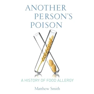 Abbildung von Another Person&#039;s Poison: A History of Food Allergy (Arts and Traditions the Table: Perspectives on Culinary History)