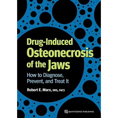 Abbildung von Drug Induced Osteonecrosis of the Jaws: How to Diagnose, Prevent, and Treat It